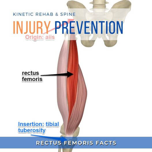 The Rectus Femoris - Kinetic Rehab & Spine Bergen County