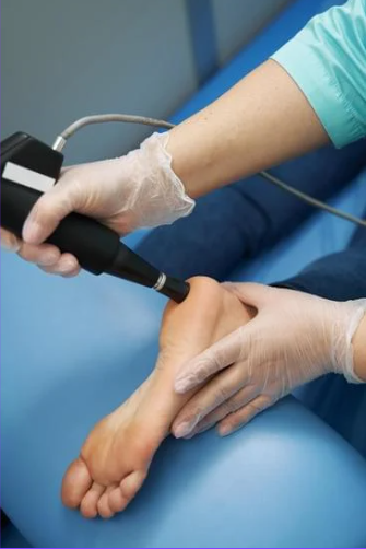 shockwave therapy for plantar fasciitis
