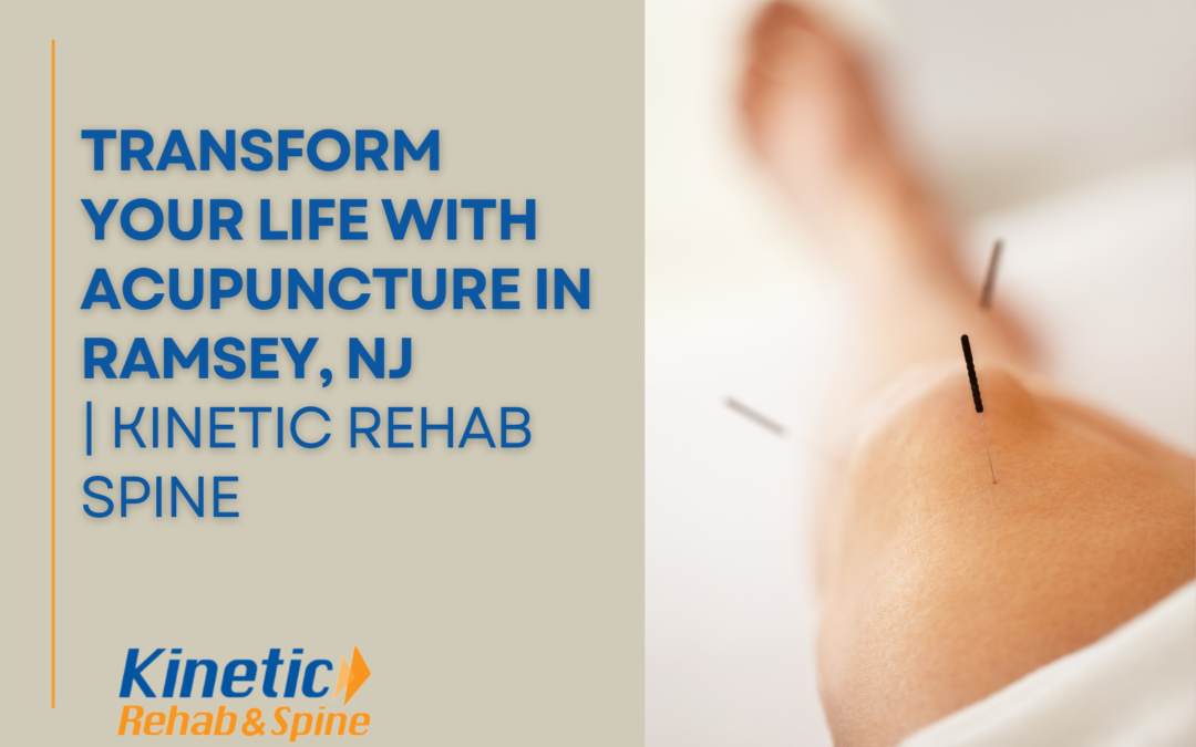 Transform Your Life with Acupuncture in Ramsey, NJ | Kinetic Rehab Spine